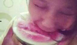 扎针吃小瓜会胖吗视频