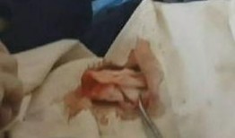 视频吃瓜刨肠子是真的吗,真相与谣言大剖析