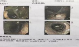 视频吃瓜刨肠子是真的吗,真相与谣言大剖析